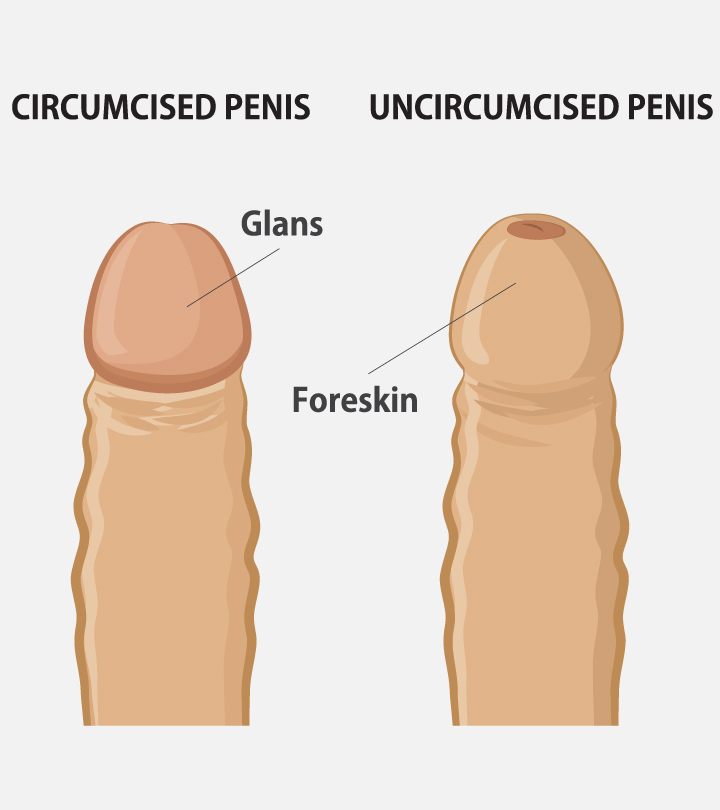 Circumcision In Teenagers: Facts, Complications And Care Tips