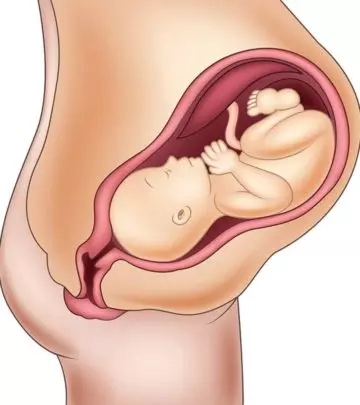 How A Baby's Position In Womb Can Affect Your Delivery