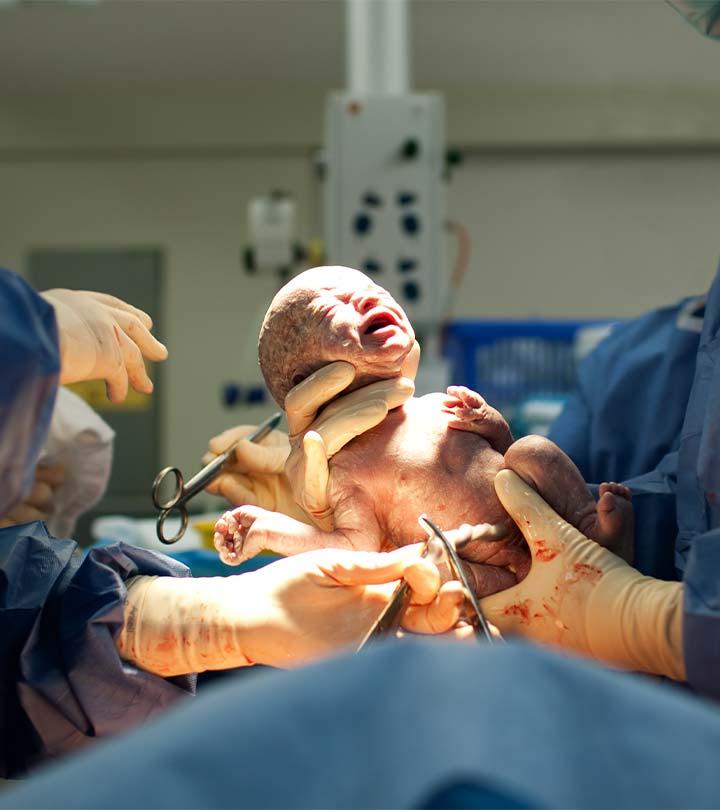 C-Sections Could Affect Genetics Of Your Pelvis