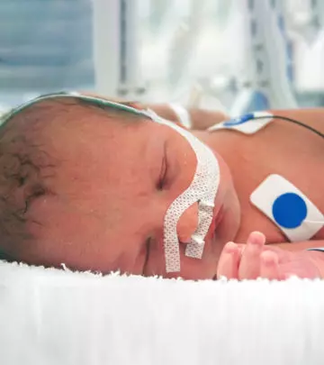 Video Of A Baby Born 3.5 Months Premature: A Living Miracle