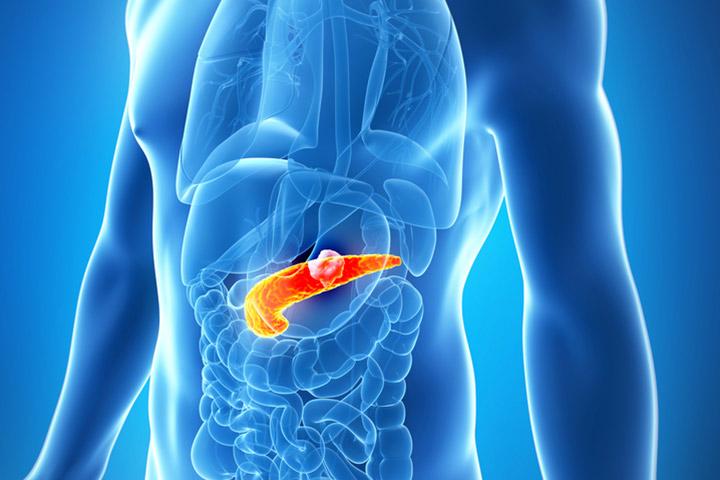 Pancreatic cancer