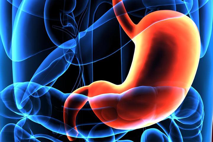 Stomach cancer