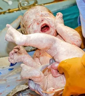 C-Section Birth Photos That Will Make You Go ‘Wow’