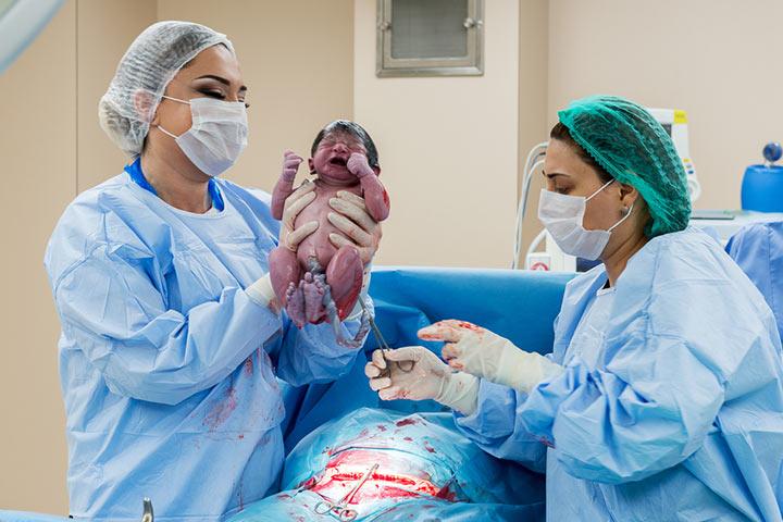 What Are Your Chances of Having a Caesarean
