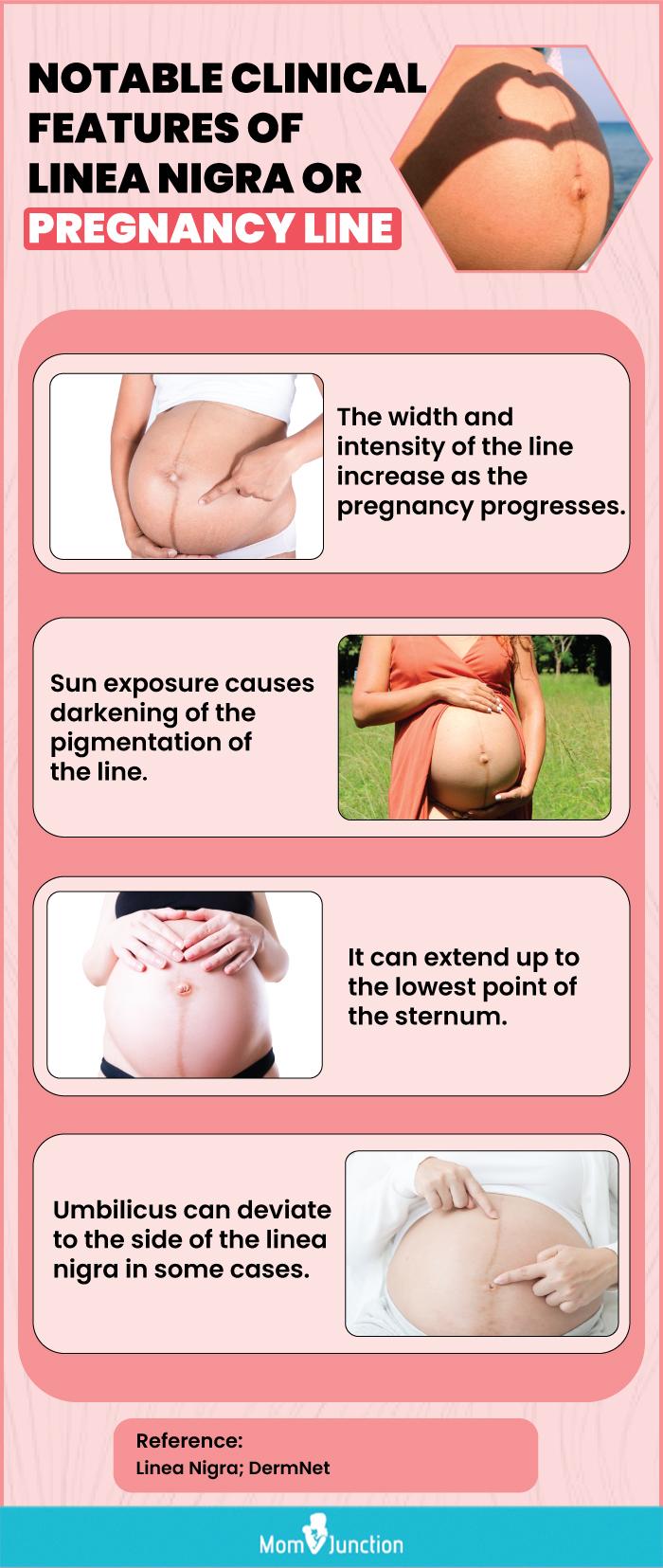 Belly line on sale gender prediction