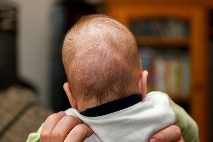 Home remedies for hot sale flat head baby