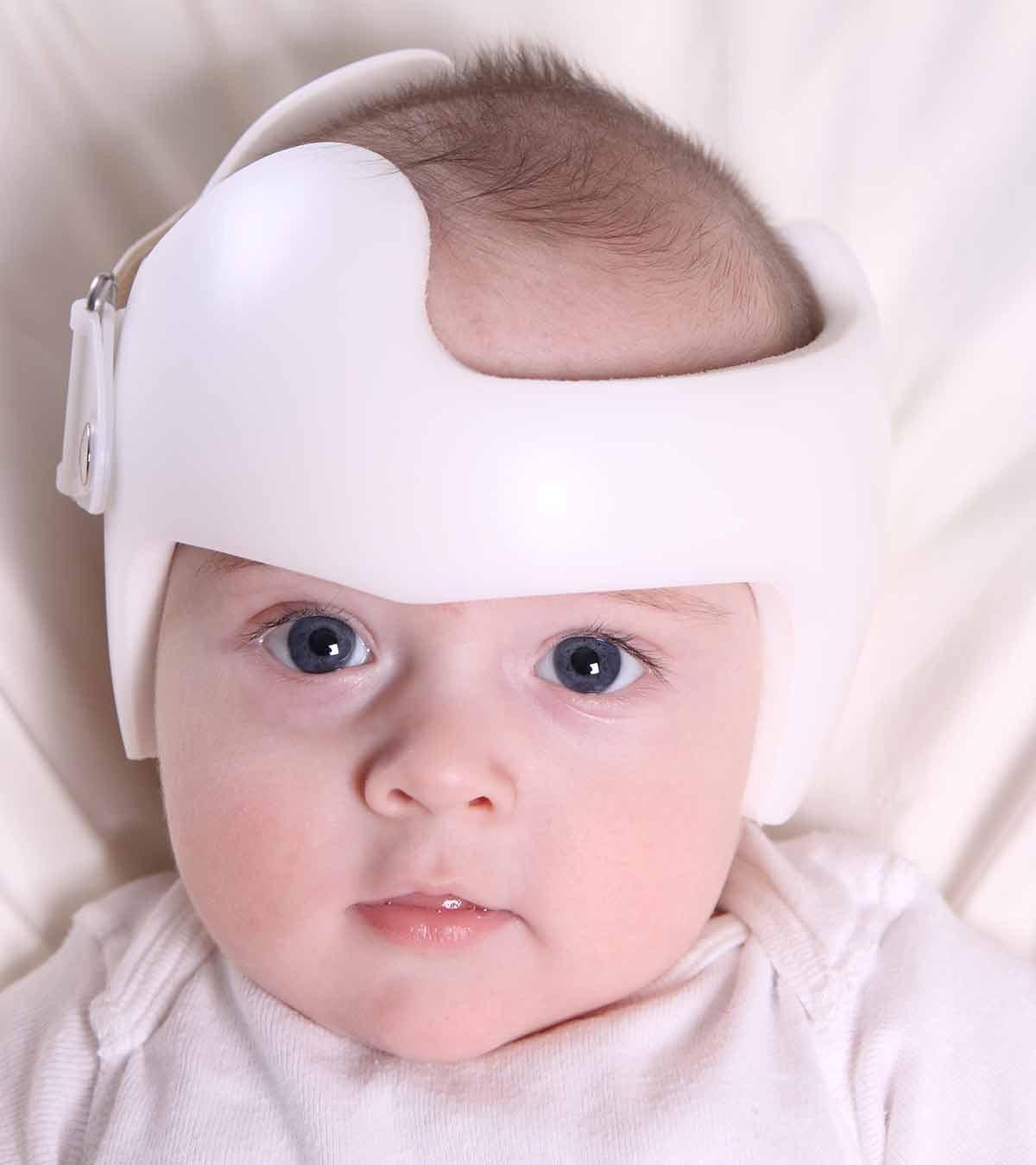 Baby Flat Head Syndrome (Plagiocephaly): Causes & Treatment