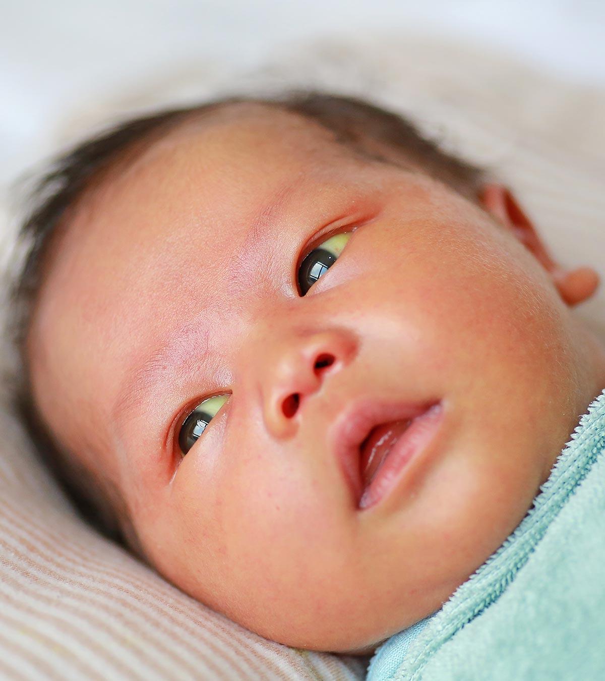 Biliary Atresia Causes, Symptoms And Treatment