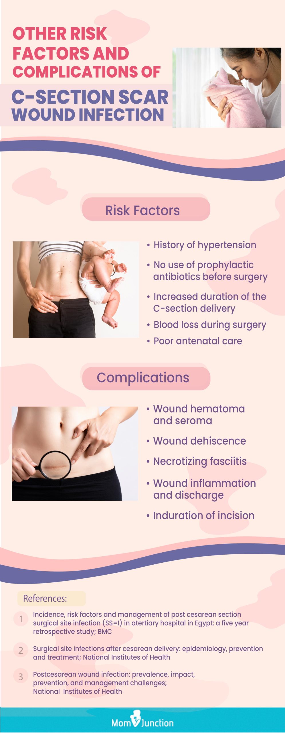 C-Section Scar Infection: Causes, Types, Signs And Treatment