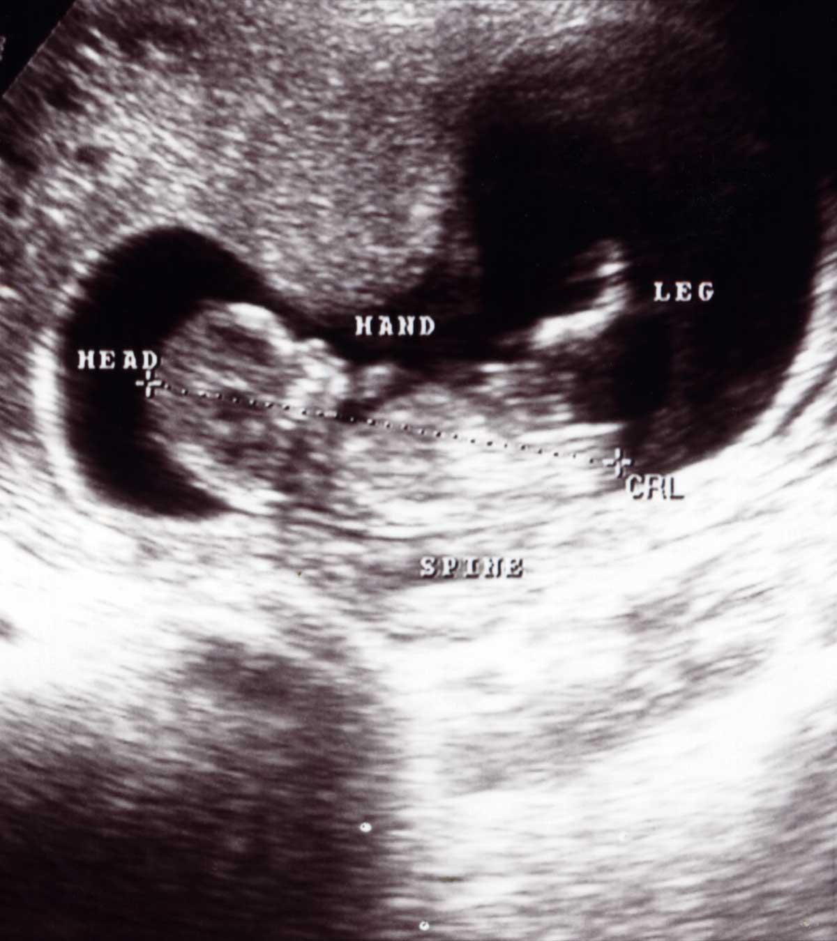 Representation Of Crown Rump Length During Pregnancy