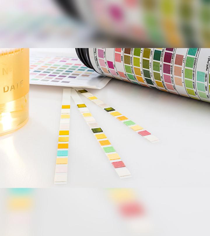 Urine color during pregnancy
