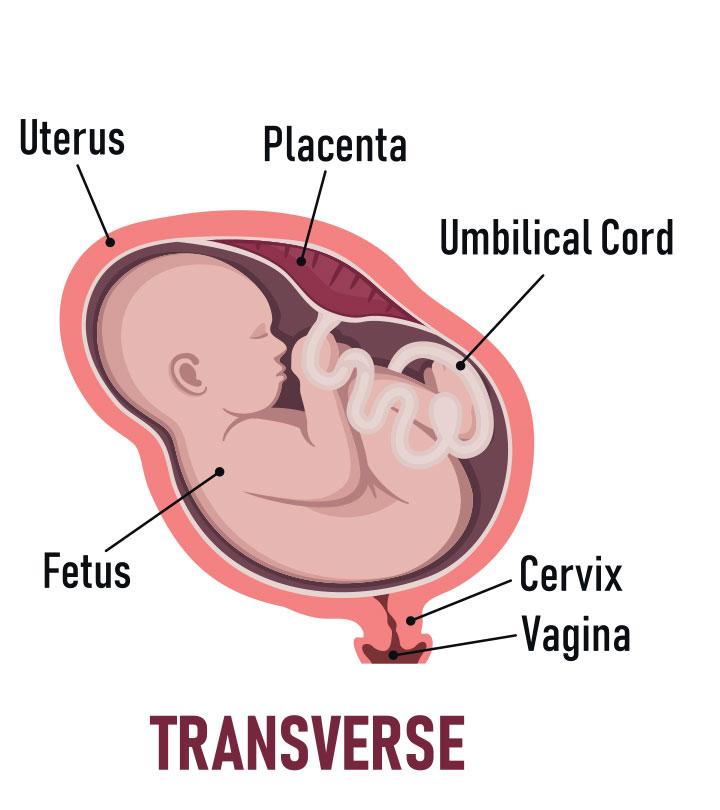 5 Ways To Turn A Baby From Transverse Lie Position