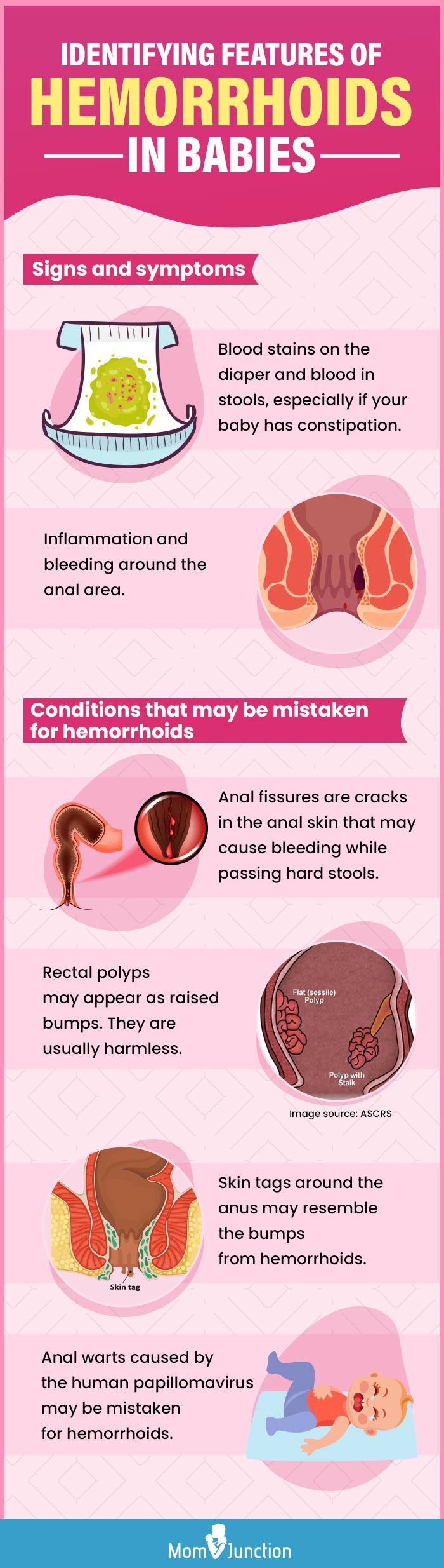 Piles/Hemorrhoids : Causes, Symptoms & What Should You Do About It? –