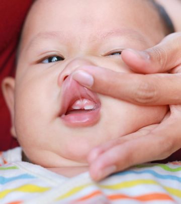 Lip Tie In Babies: Causes, Signs, Complications & Treatment