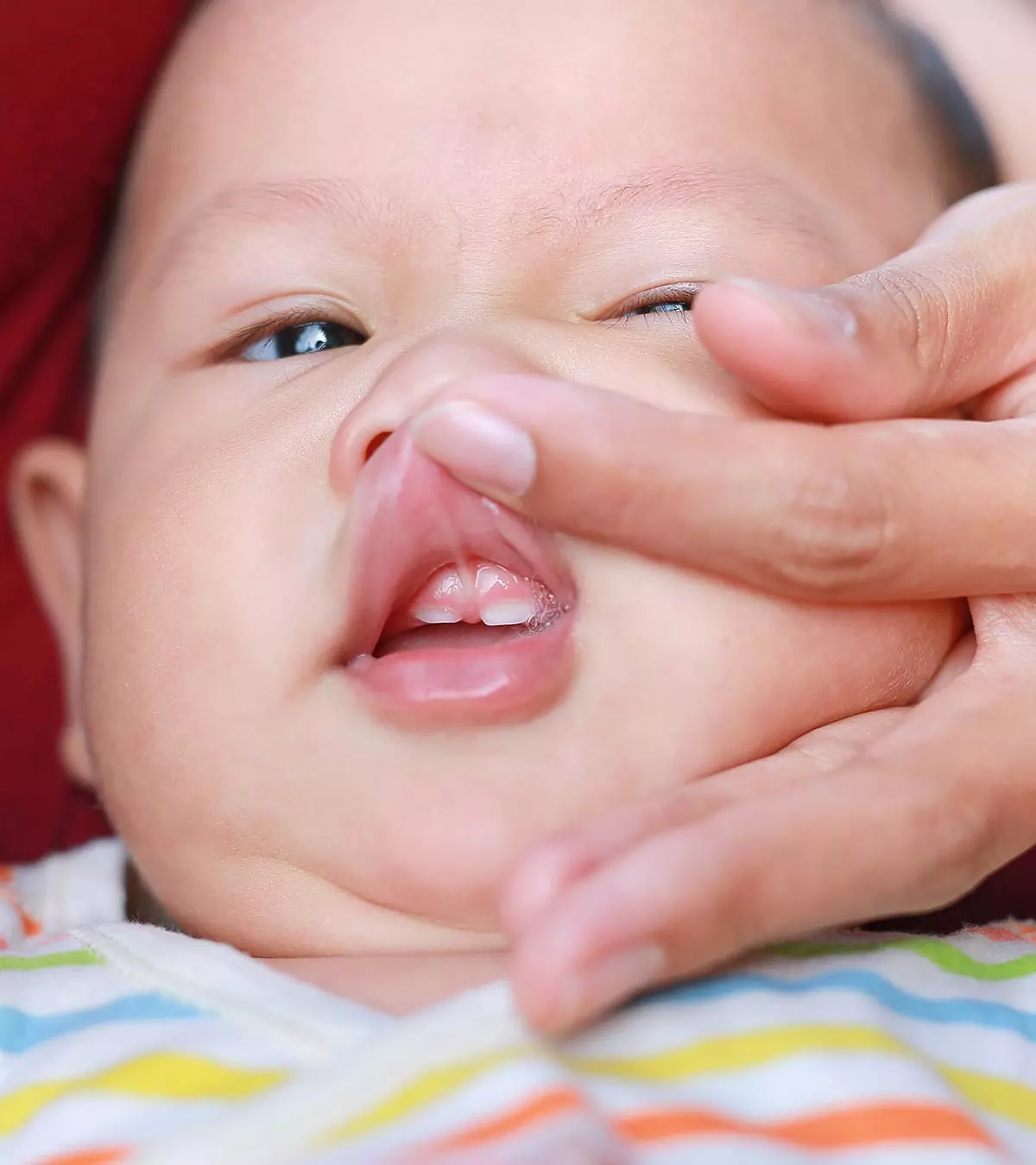 Lip Tie In Babies Causes Signs Complications Treatment