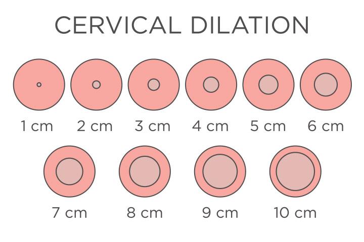 Cervix Dilation Chart Signs Stages And Procedure To Check 47 OFF