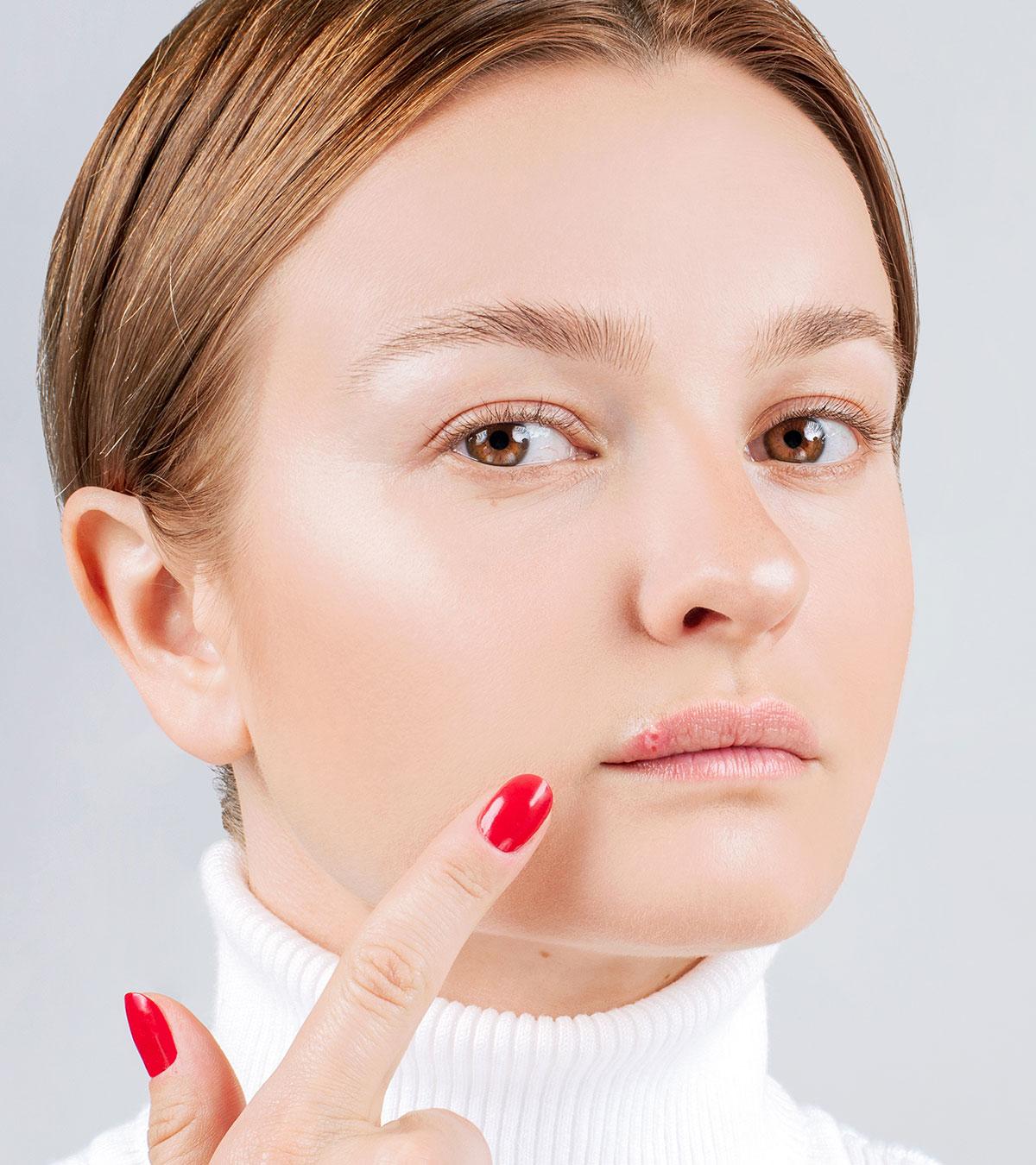 Women Suffering With Cold Sores During Pregnancy