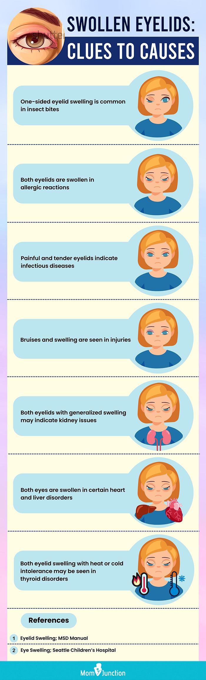 15 reasons you have puffy eyes in the morning!