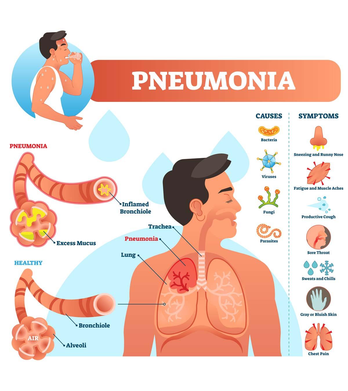 Symptoms Of Pneumonia In Teens