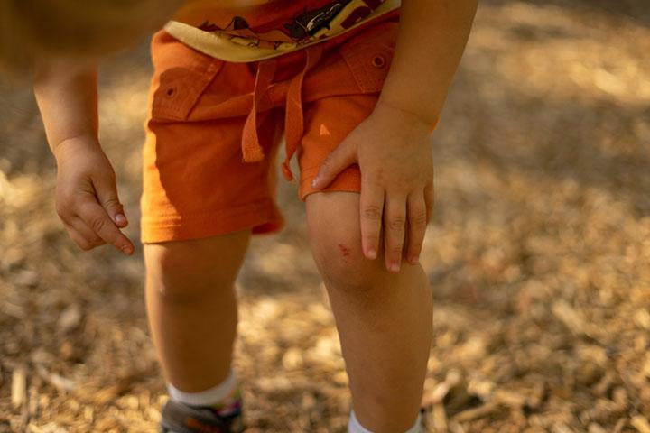 Do Babies Have Kneecaps And When Do They Form?