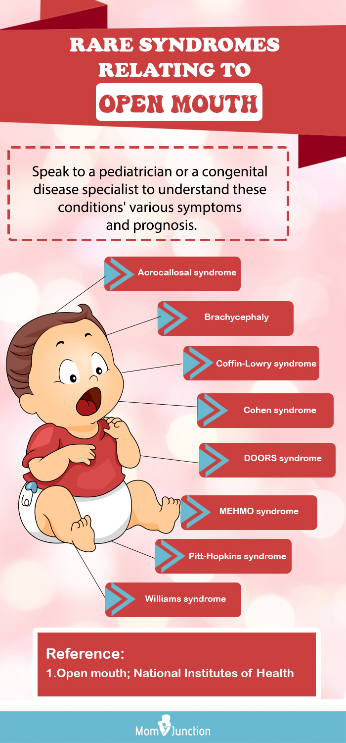 rare syndromes relating to open mouth (infographic)