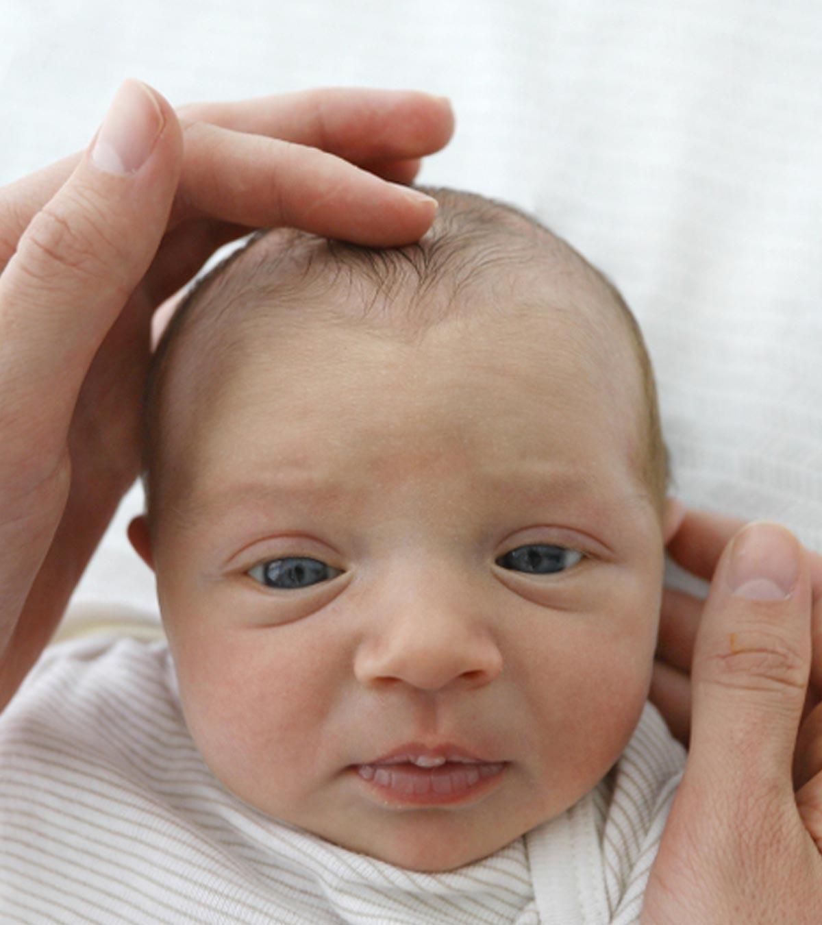Baby With Sunken Fontanelle