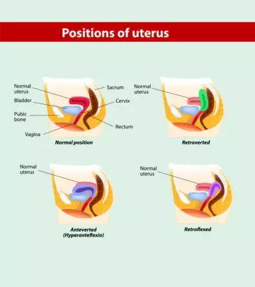 प्रेगनेंसी में एंटेवर्टेड यूटेरस: कारण, लक्षण व इलाज  | Anteverted Uterus Meaning In Hindi