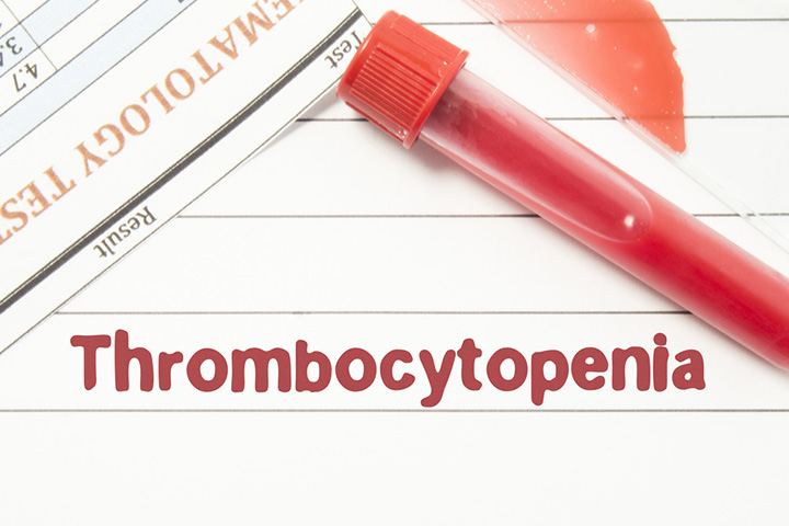 Neonatal Thrombocytopenia Causes Symptoms And Treatment