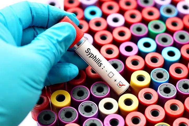 Syphilis In Babies Symptoms, Diagnosis And Treatment