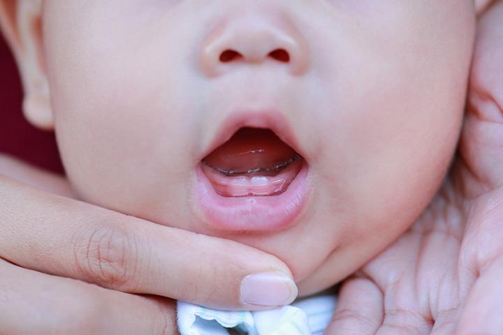 Baby Spitting Up Clear Liquid? Causes and When to Call the Doctor