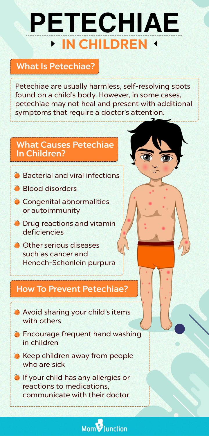 Petechiae In Children: Causes, Symptoms And Treatment