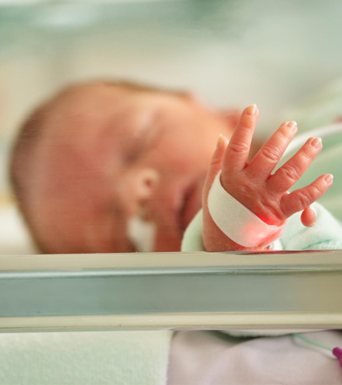 A Baby With Polydactyly