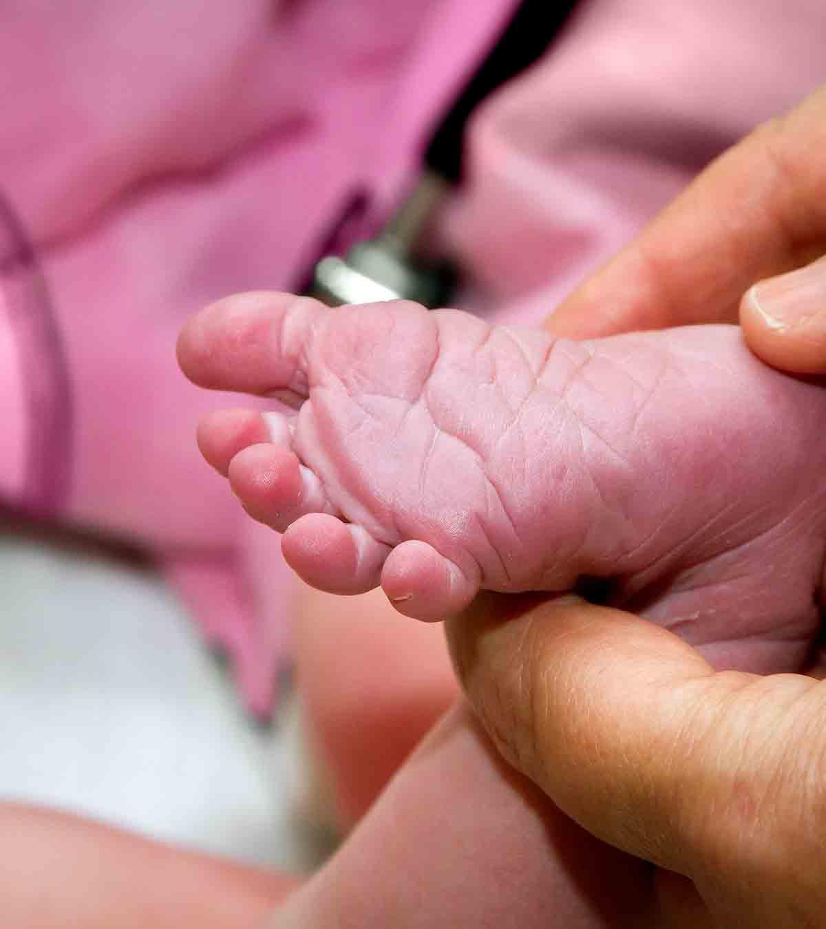 Doctor Checking Babinski Reflex In A Baby