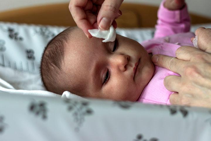 Baby swollen online eye
