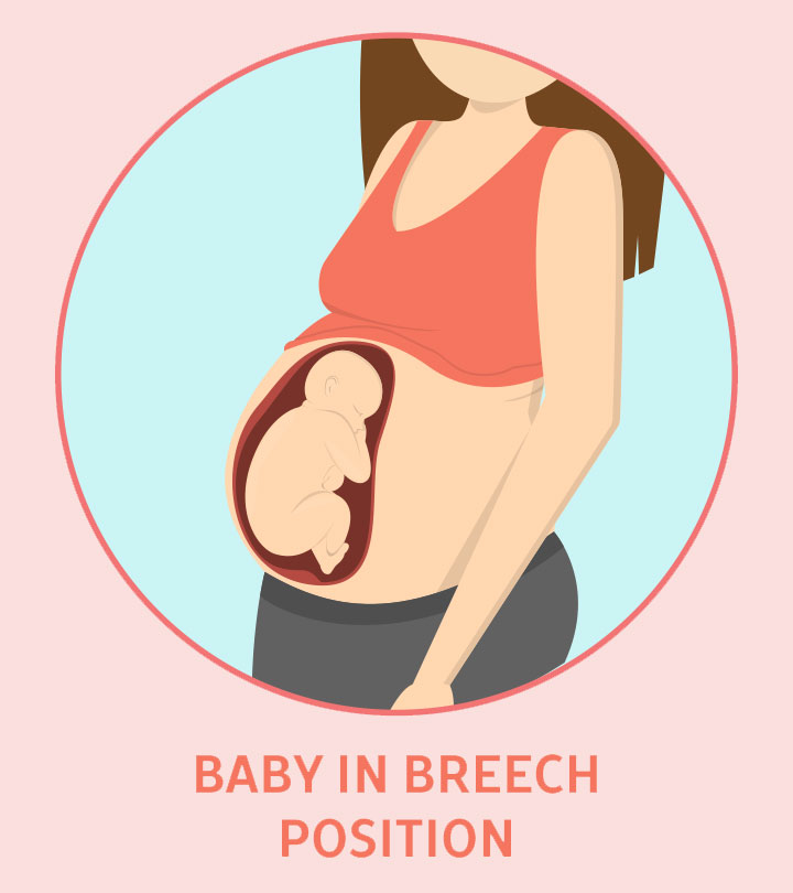 7 Common Breech Baby Birth Defects And Their Complications