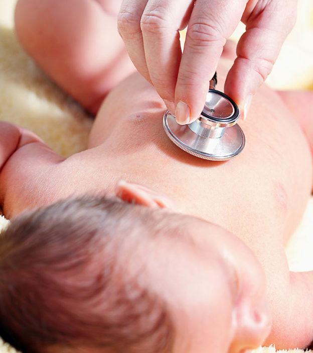 Beckwith-Wiedemann Syndrome In Babies: Causes & Treatment Beckwith-Wiedemann Syndrome In Babies: Causes & Treatment