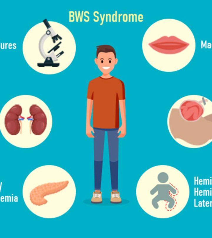BeckwithWiedemann Syndrome Symptoms, Causes And Treatment
