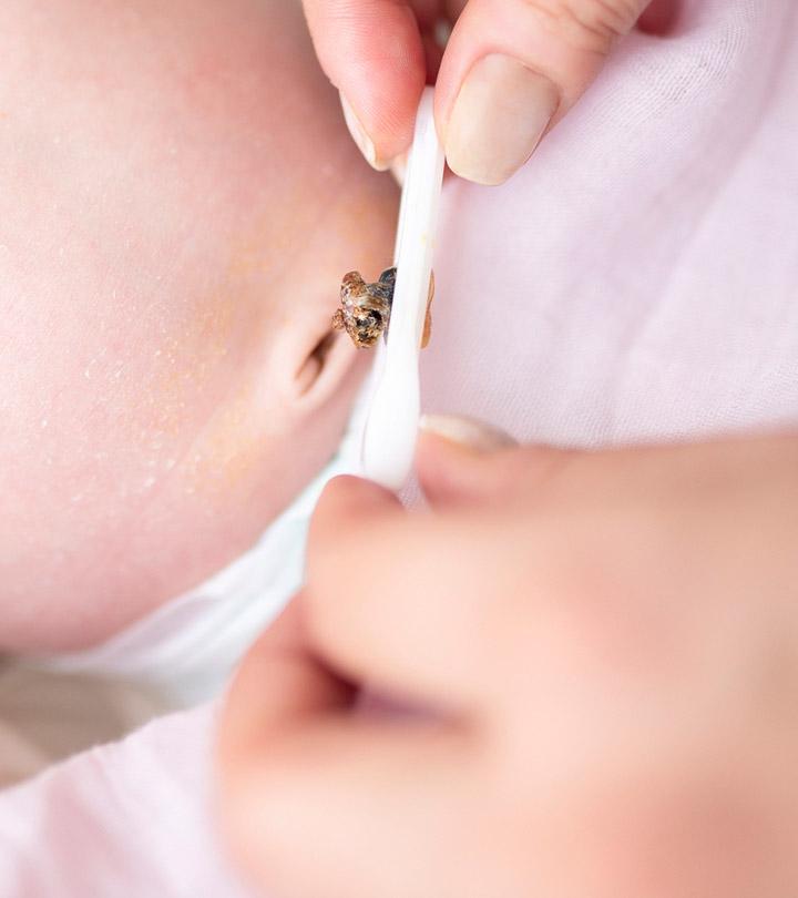 Baby With Umbilical Granuloma Receiving Care