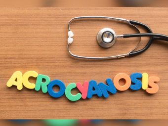 Acrocyanosis In Newborn: Causes, Symptoms, Diagnosis And Treatment
