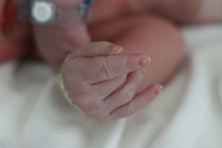 Acrocyanosis In Newborn: Causes, Symptoms And Treatment