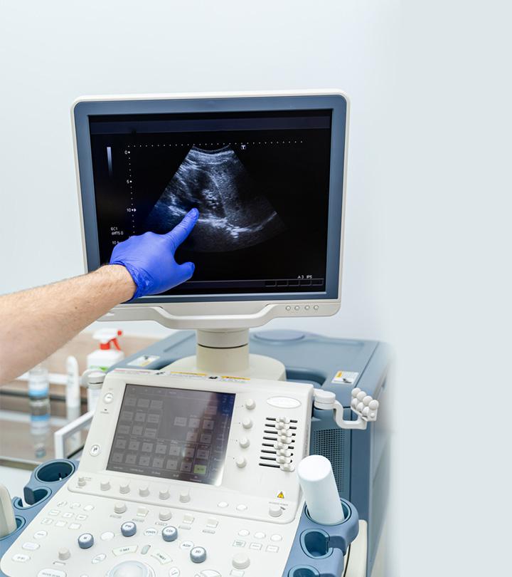Ultrasound image at 5 weeks of pregnancy
