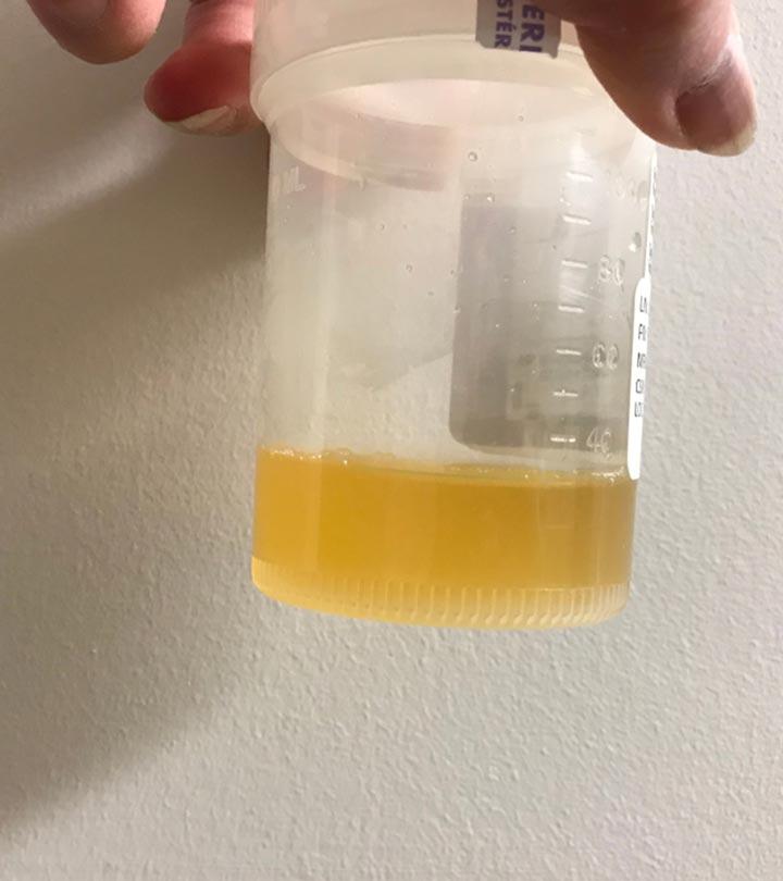 Early Pregnancy Urine Color Change English 