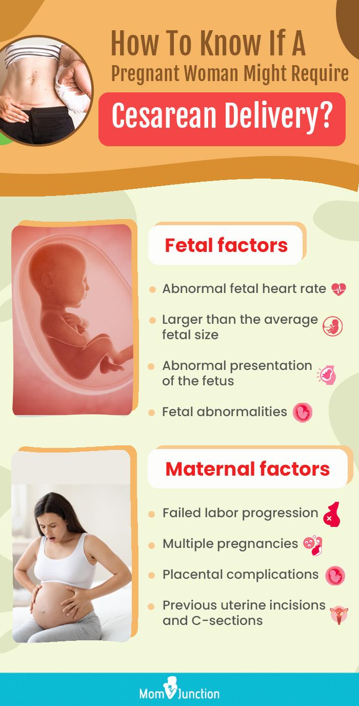 Vaginal Vs. Cesarean Delivery