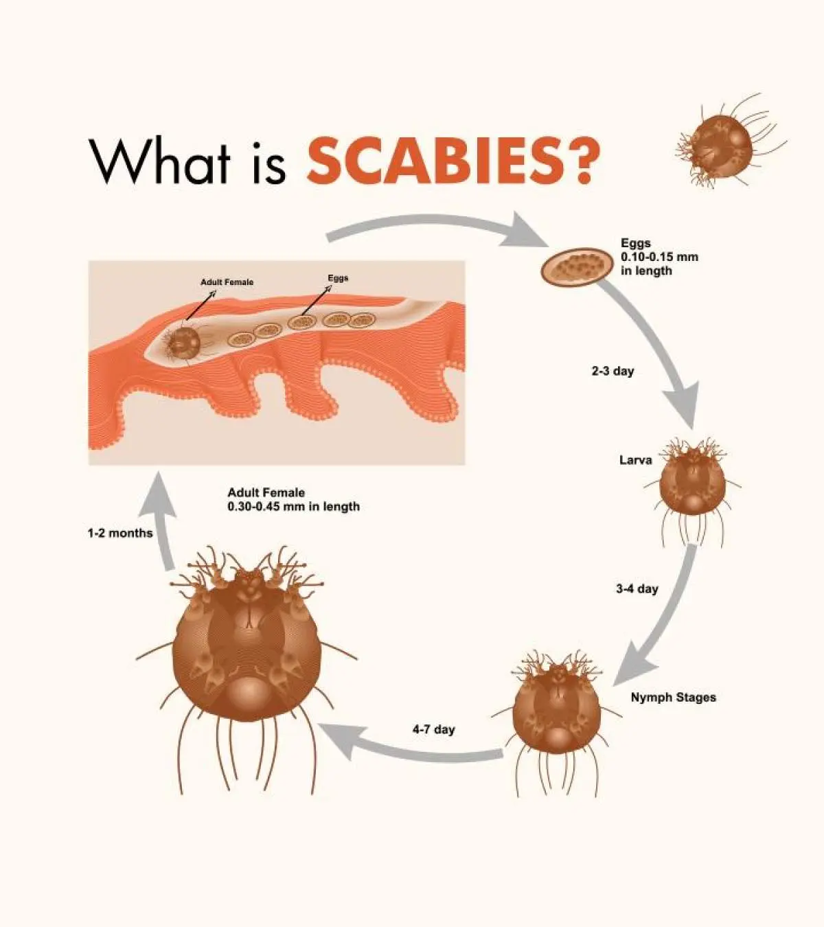 Scabies In Children Causes Symptoms Treatment Guide