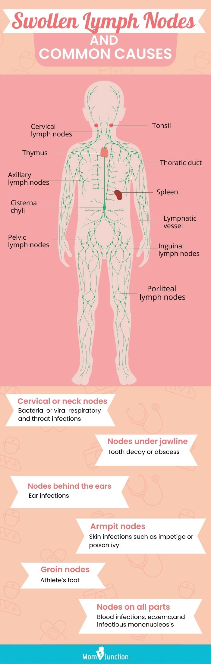 Swollen lymph nodes in groin: 9 causes