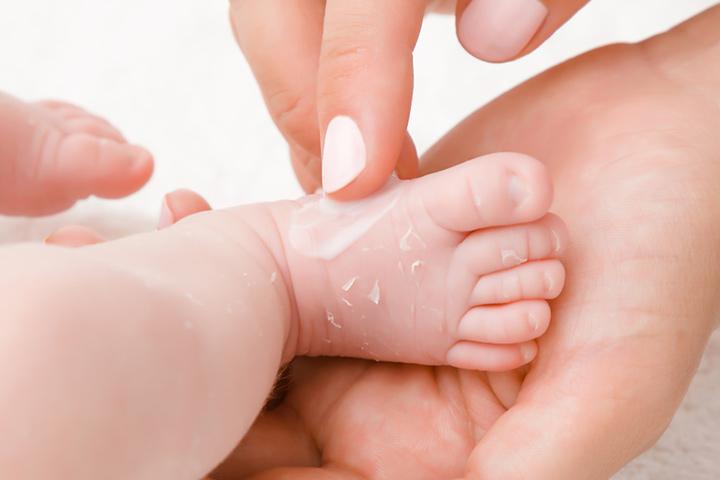 Select a moisturizer for your baby depending on the severity of dryness