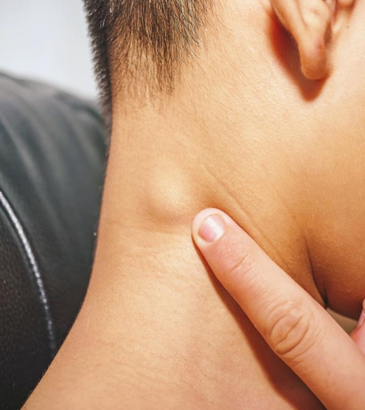 A Boy With Swollen Lymph Nodes In Neck