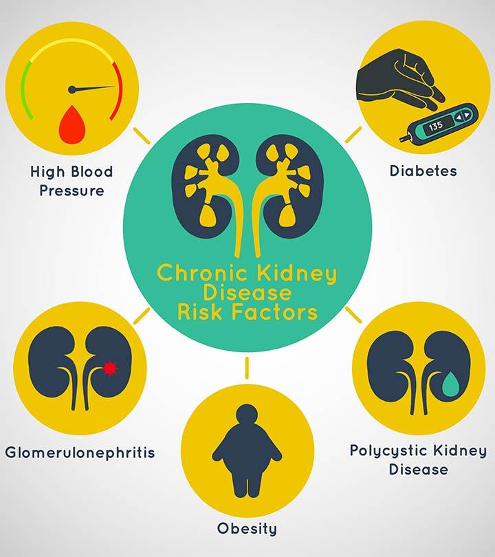 Kidney disease risk factors