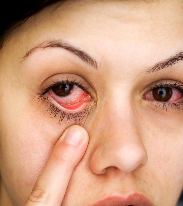 Women With Pink Eye During Pregnancy