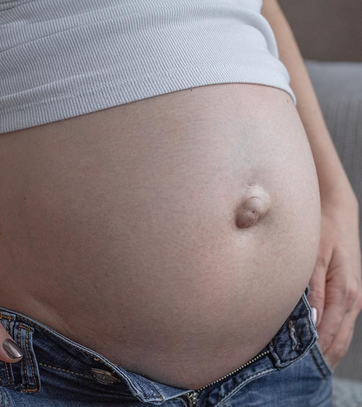 What Causes Umbilical Hernia In Pregnancy & How To Treat It?